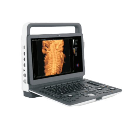 KAL-M30 Color Doppler Ultrasound System